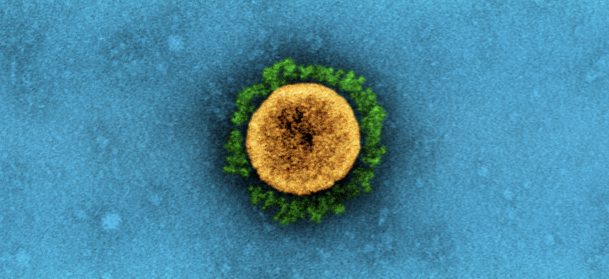 Electron microscope picture of a SARS-CoV-2 virus particle. The prominent projections (green) seen on the outside of the virus particle (yellow) are spike proteins. Image captured at the NIAID Integrated Research Facility (IRF) in Fort Detrick, Maryland.